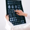 Нейрогуморальная регуляция деятельности организма контролируется 1гипоталамусом